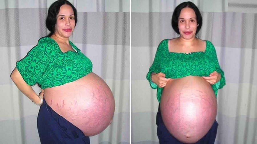 Heres What Nadya Octomom Suleman And Her Kids Look Like Today - Nadya Suleman Guff